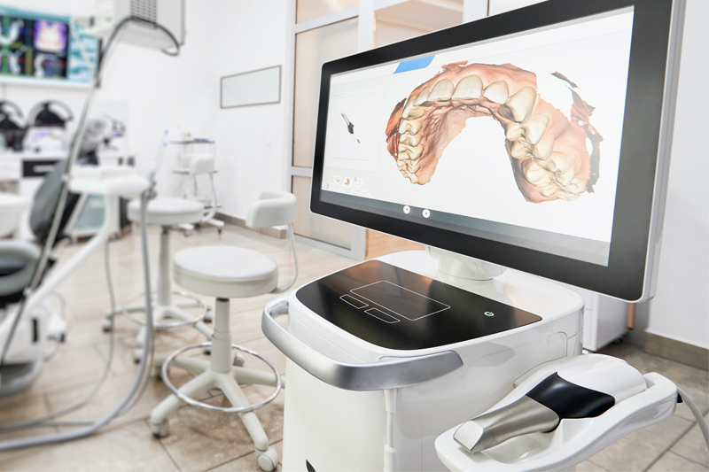 Intra-Oral Scanner in Indianapolis